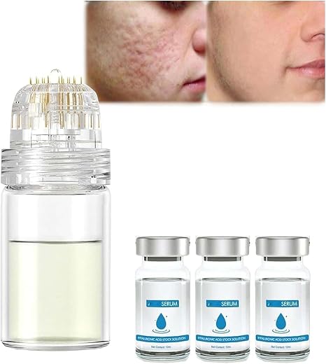 Mikro-Infusionssystem für Lippen Mikrosystem für Gesicht Gesichtsbehandlung mit Serum PockmarksHeal Mikronadel-Roller mit Hyaluronsäure Serum für glatte Haut 3er-Set