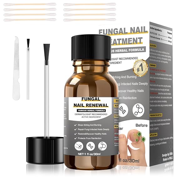 Toenail Fungus Treatment Extra Strength,Fungus Nail Treatment,Nail Fungus Treatment For Toenail,Athletes Foot Treatment,Ingrown Toenail Treatment,Toe Nail Fungus Treatments For Fungi Nail(1fl oz/30ml)